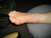 gwen ankle 1.JPG